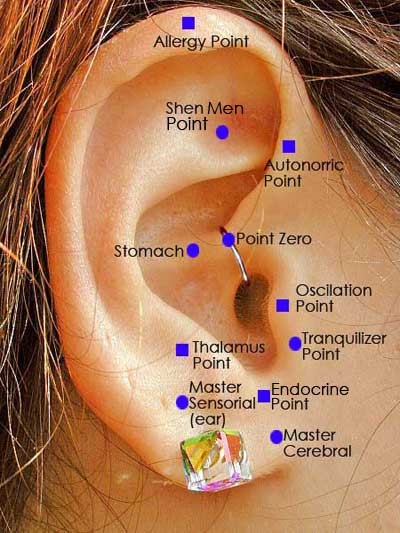 Auricular Therapy in Phoenix, AZ | Suddenly Slimmer Med Spa