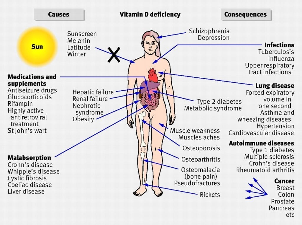 Vitamin D Injections in Phoenix, AZ Suddenly Slimmer Med Spa