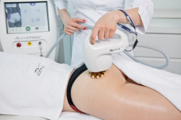 Body Sculpting Ultra Rf Post Care At Suddenly Slimmer Med Spa Phoenix